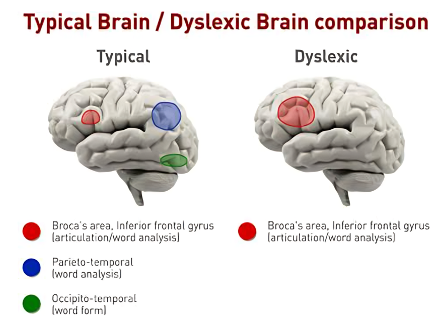 Brain activity scans