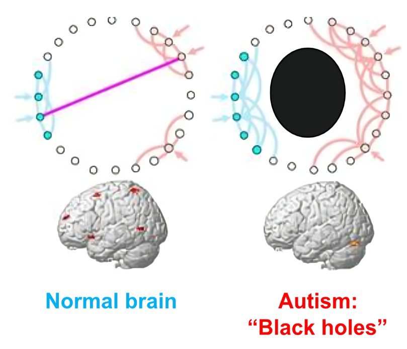 Autism brain connectivity